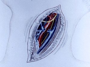 Jugular Vein