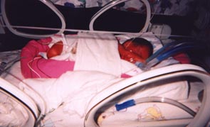 Asleep in her isolette