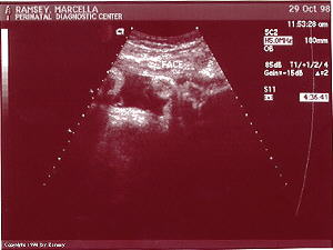 Baby has it's hand to it's face, look closely!