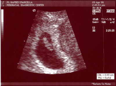 7 weeks 0 days