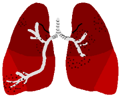 ��Ŧ lung