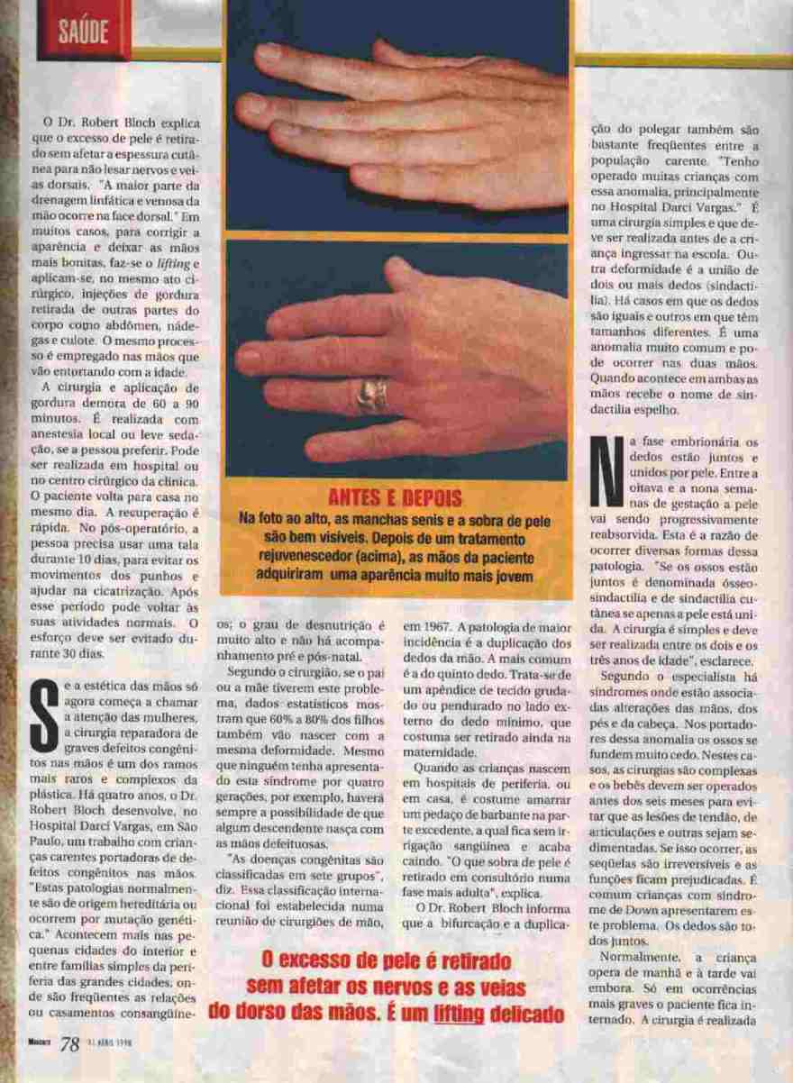 reportagem de 11 de abril de 1998 - se��o Sa�de - p�g 78