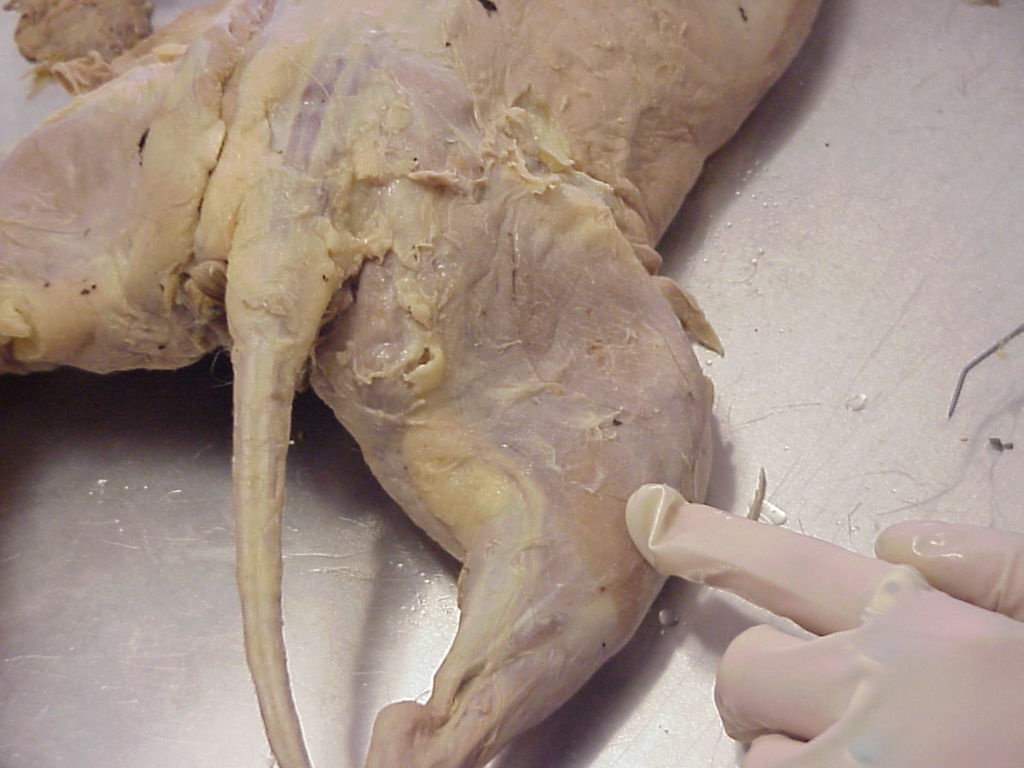 biceps femoris