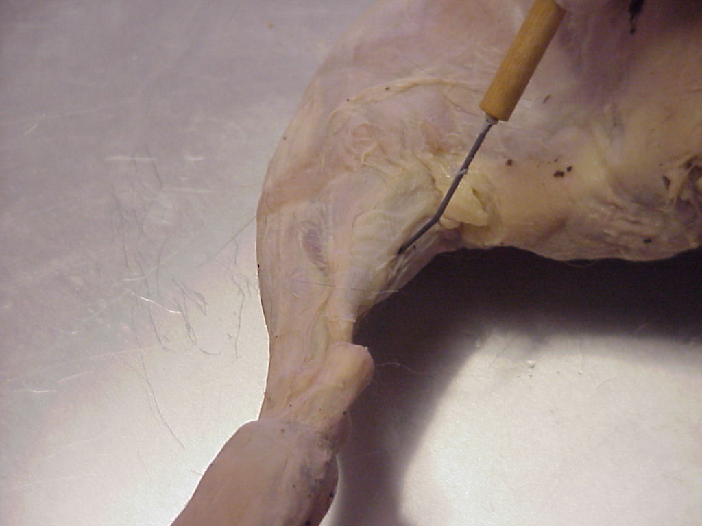 gastrocnemius