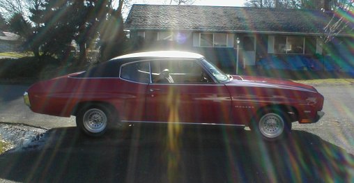 [Right side view]