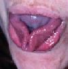 [Tongue]