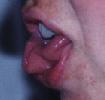 Tongue side