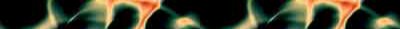 shellshcklgbar.jpg (3108 bytes)