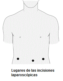 Mammogram