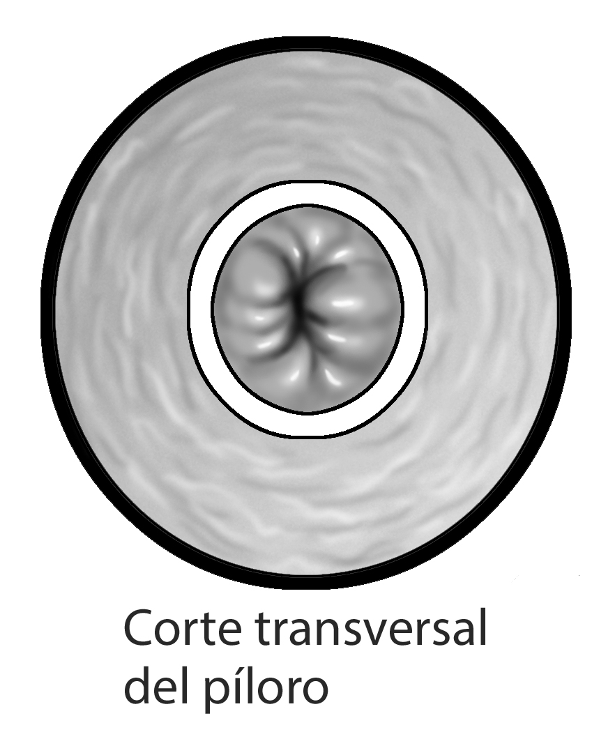 child gastro tract