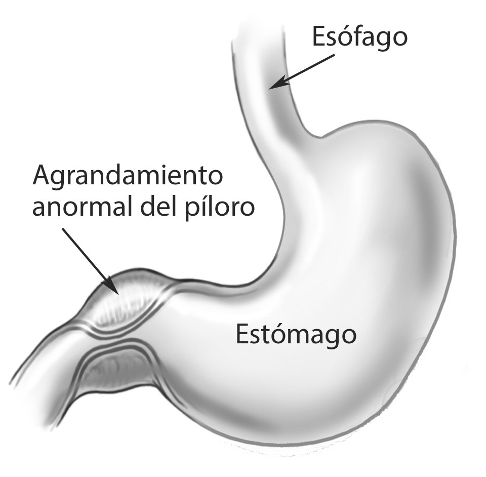 pyloric s-stomach-peds