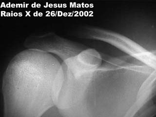 Raios X de 26 de Dezembro de 2002