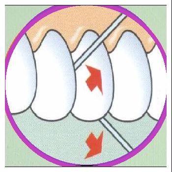 3 - Introduza o fio com um movimento de vai e vem.
