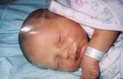 Alexander in the hospital cradle.