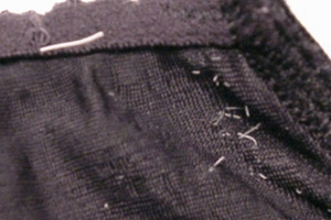 frayed elastics in band