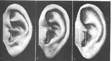 Anatomical landmarks on the ear