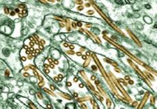 The A H5N1 virus, which causes Avian flu