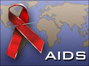 HIVaids