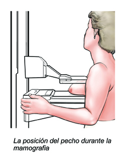 Mammogram
