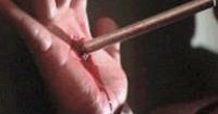 [Bob gets hand impaled]