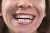 Dentistry moderno