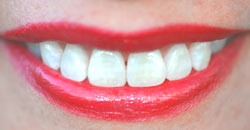 Dental care. Capacidades del tratamiento de los dientes.