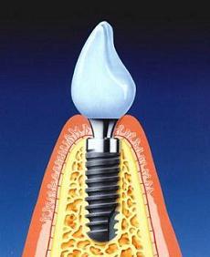 Odontoiatria moderna. Dental care.