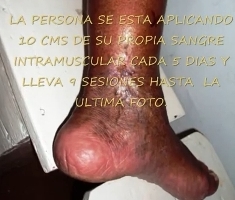 orice organe în pelvis mici programul tablet varicoză