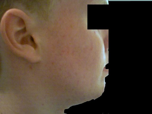 Right Side 130days (mostly clear)