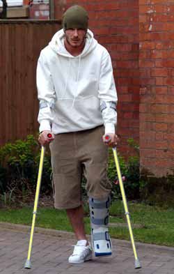 Becks on crutches!