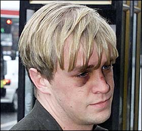 Kian after the attack