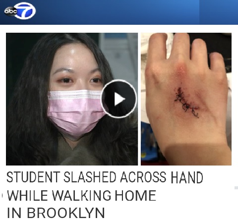 College Student - Asian American - Hand Slashed