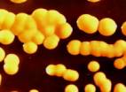 Coco, Staphilococcus aureus