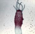 This is a hydra, which is an example of an 
invertebrate in the Cnidarian phylum