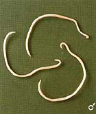 This is 
a roundworm, which is an example of an invertebrate in the Nematoda phylum