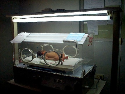 ni�o en incubadora + fototerapia