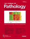 Journal of Pathology