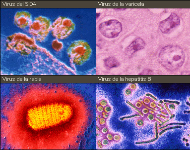 virus.JPG (118034 bytes)