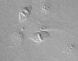 20X DIC Image