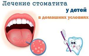 чертежи спортивных малых архитектурных форм