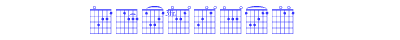 Frets