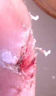 finger0 (6K)