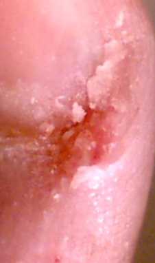 finger1 (6K)