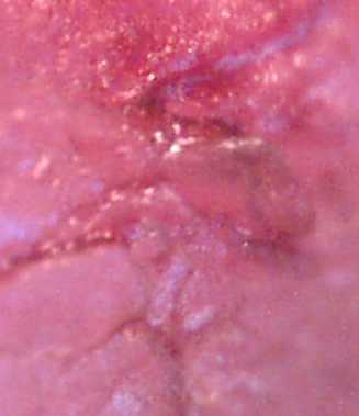 finger10 (8K)