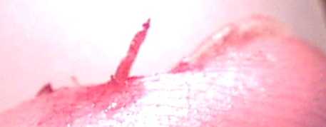 finger11 (5K)