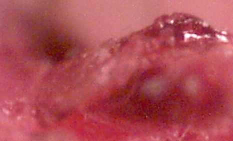 finger8 (9K)