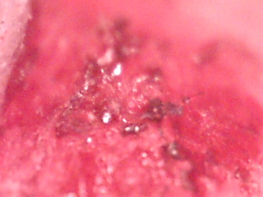 closeup2 (50K)