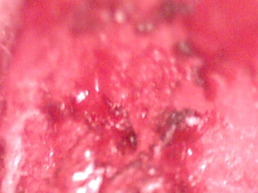 closeup3 (52K)