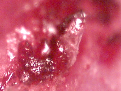 closeup6 (62K)
