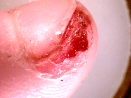 finger10x (47K)